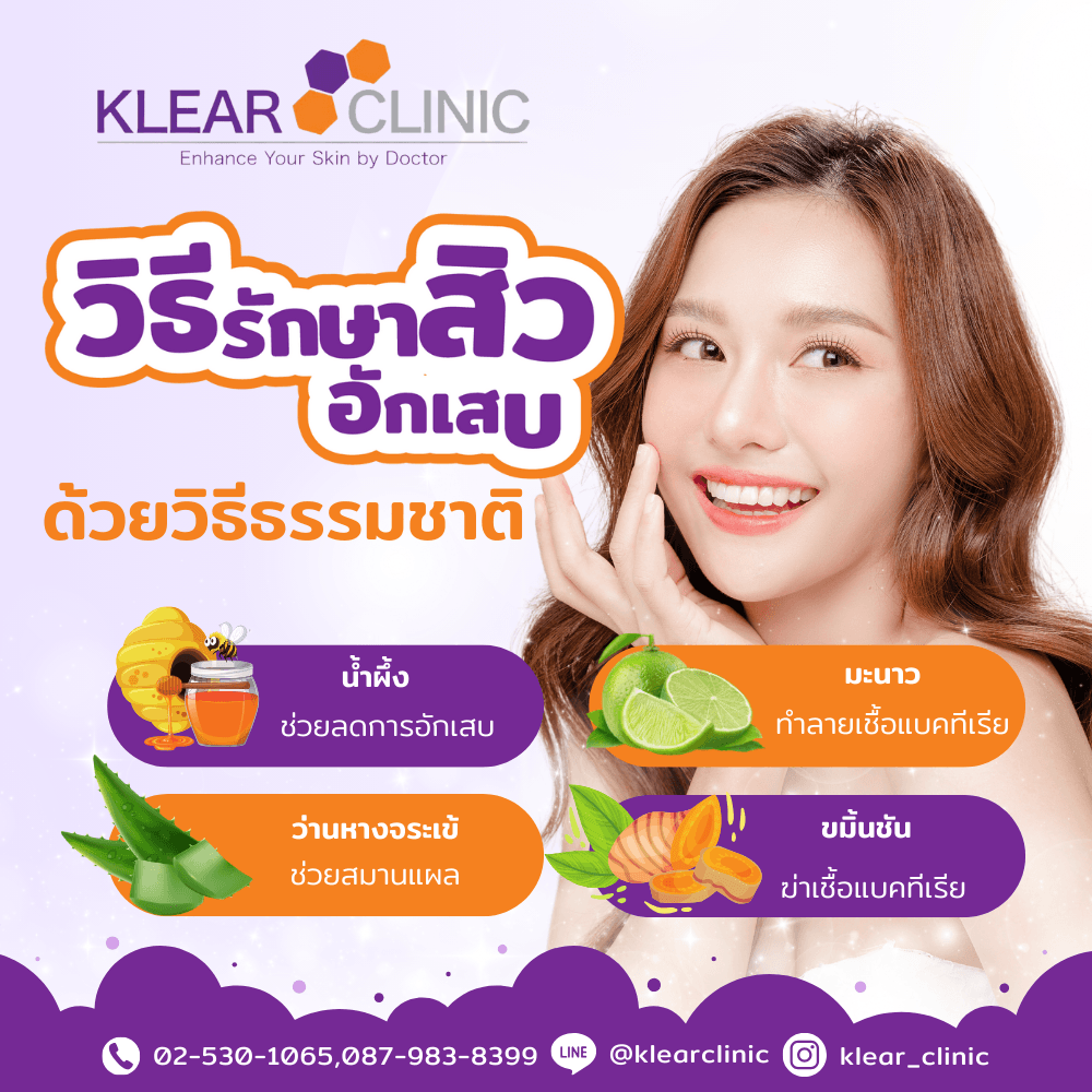 รักษาด้วยวิธีธรรมชาติ